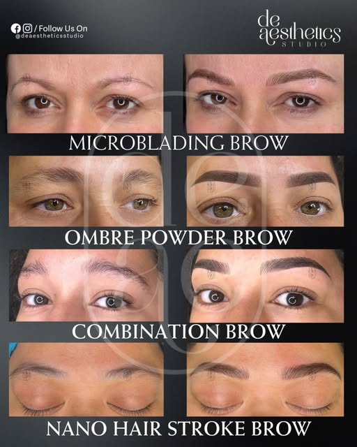 A comparison of natural-result brow techniques